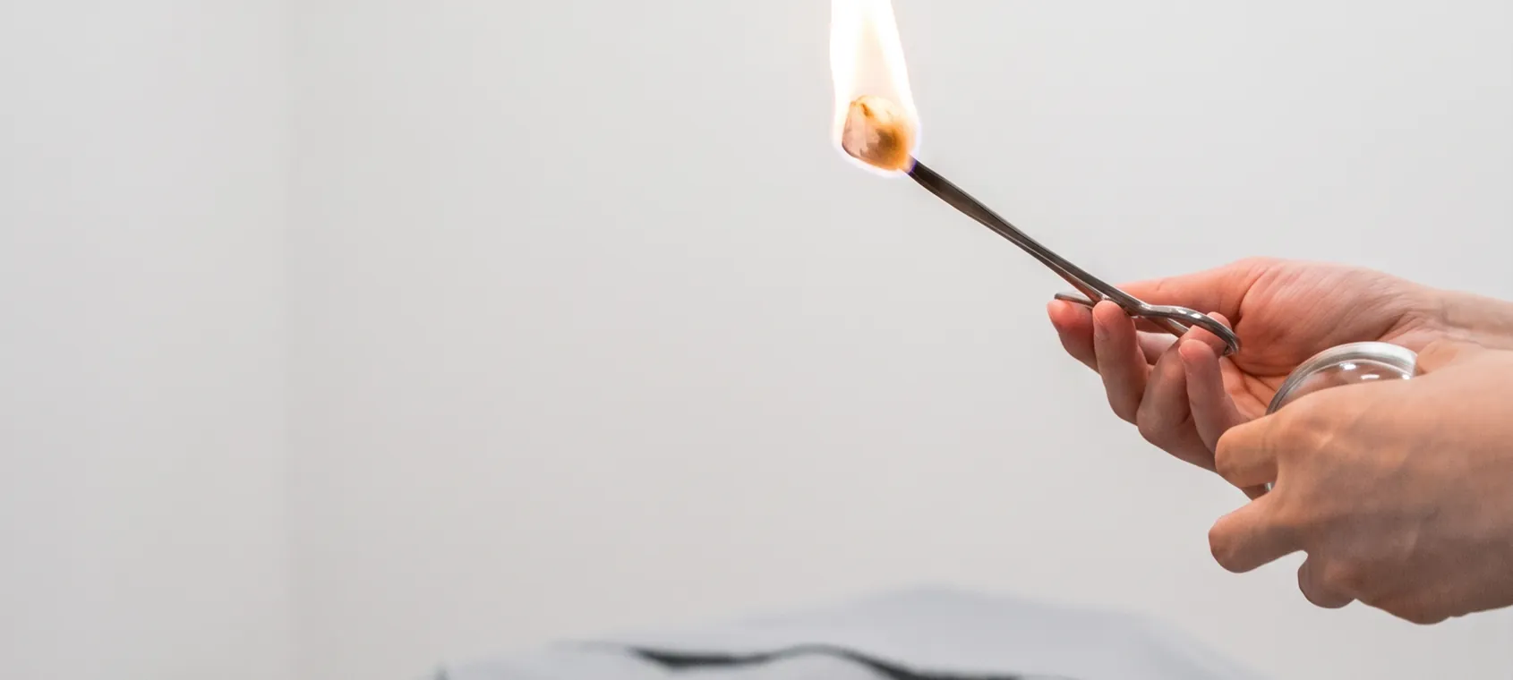 Moxa flame therapy administered during an acupuncture treatment at Fittopia Wellness Studio.